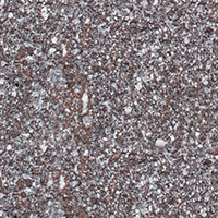 Porphyry